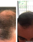 PROMO TRIO - Perte de cheveux progressive - Cure 3 mois - René Furterer - 53 Karat