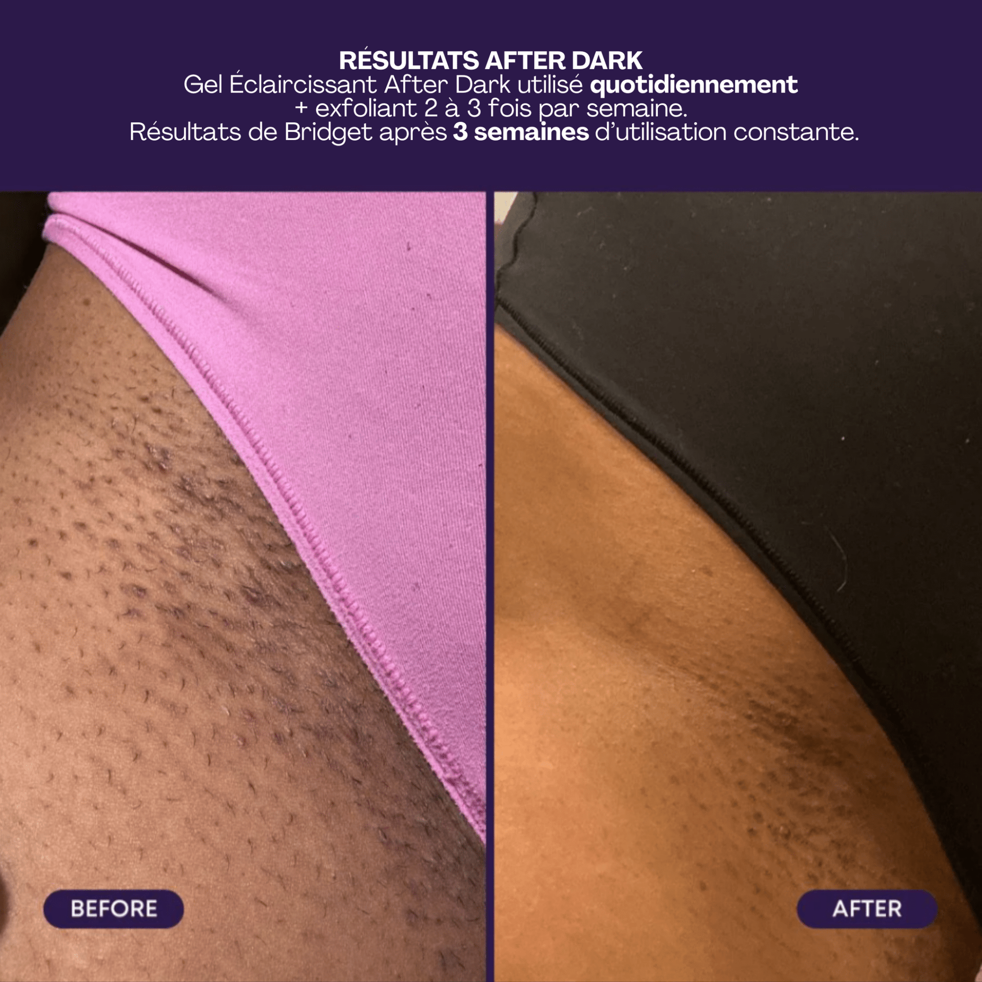 BushBalm | After Dark | Gel Éclaircissant Nuit - 53 Karat