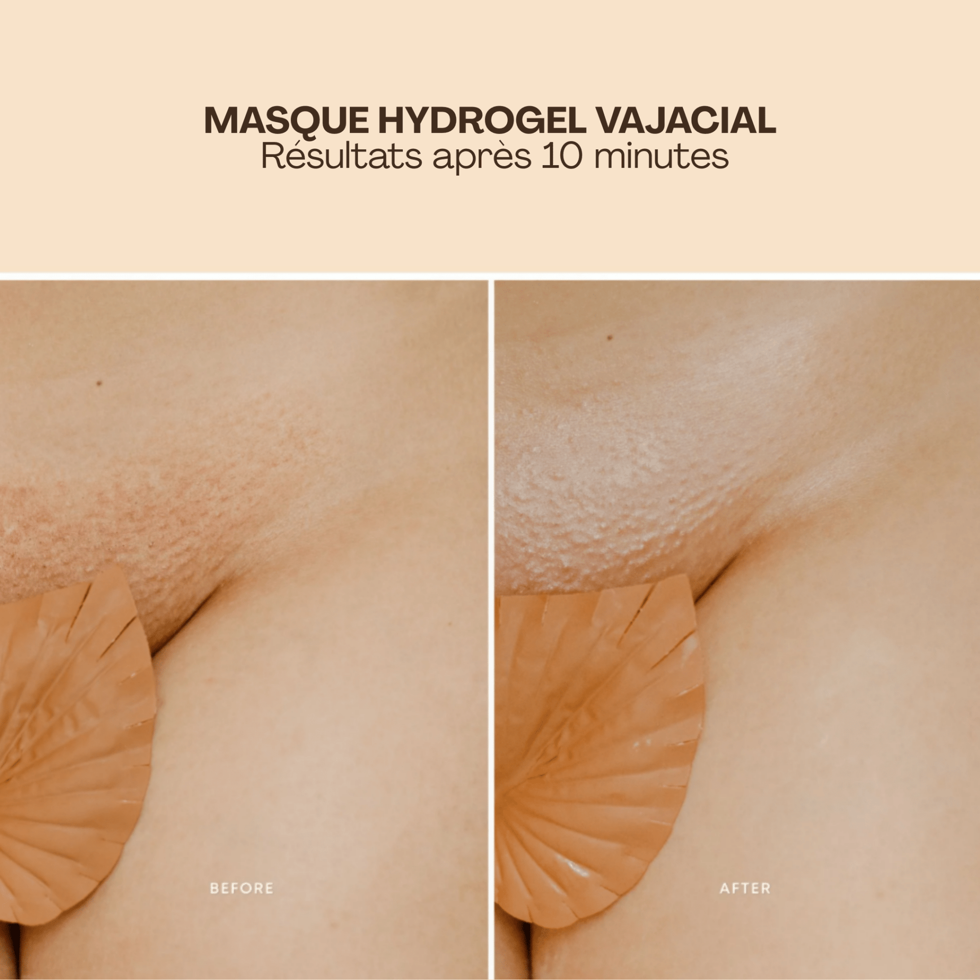 BushBalm | Hydrogel Vajacial | Masque Bandes - 53 Karat