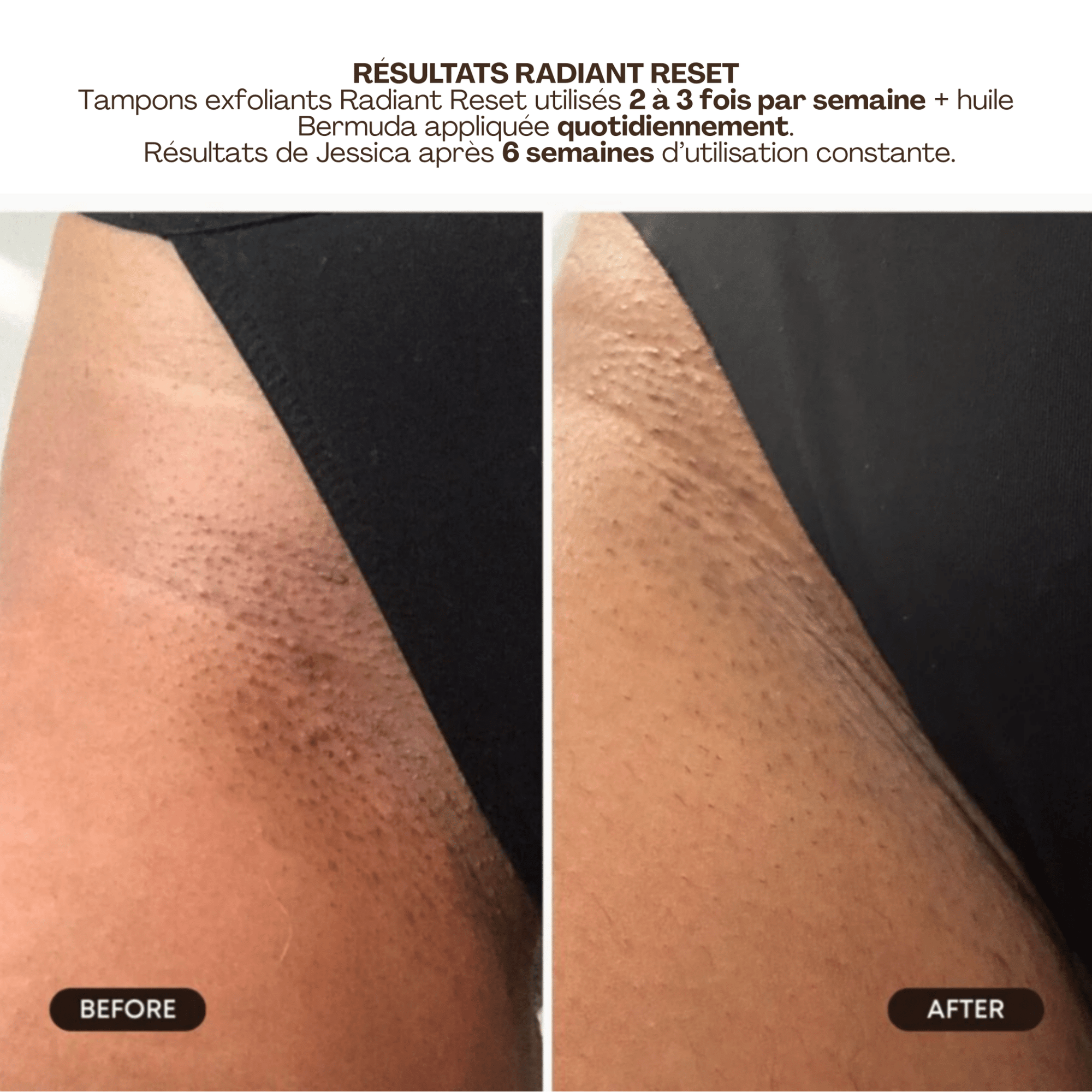 BushBalm | Radiant Reset | Tampons Exfoliants Toniques - 53 Karat