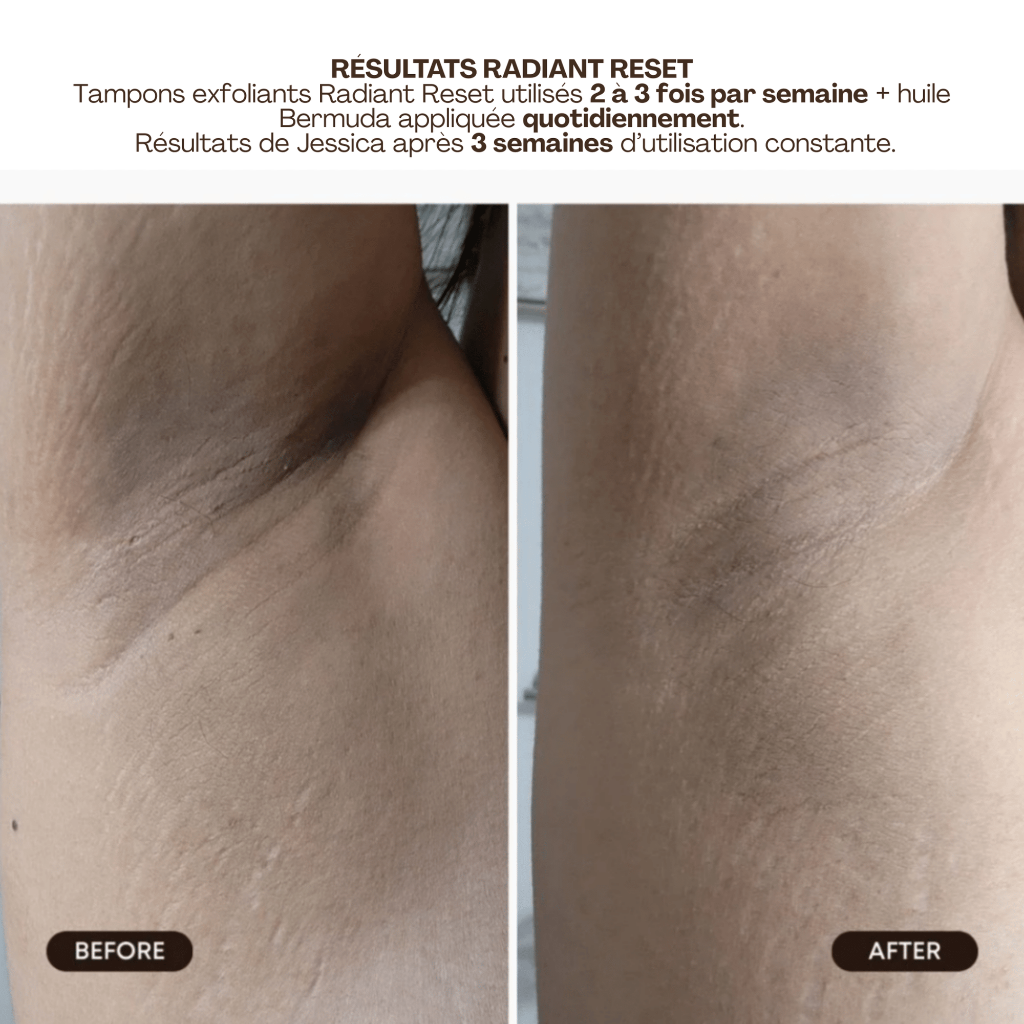 BushBalm | Radiant Reset | Tampons Exfoliants Toniques - 53 Karat