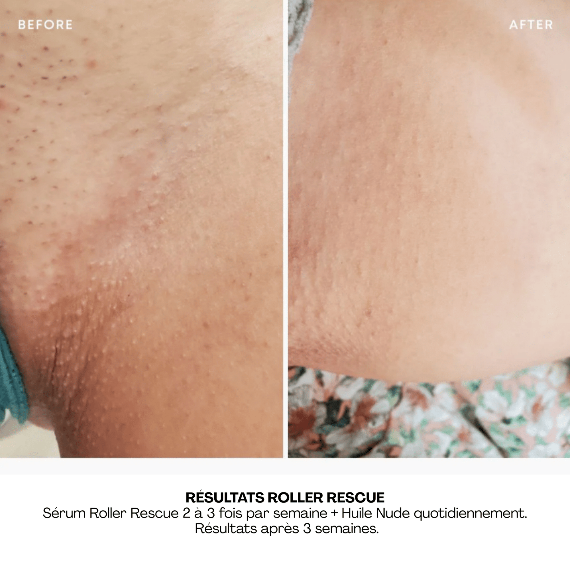 BushBalm | Roller Rescue | Sérum Apaisant - 53 Karat