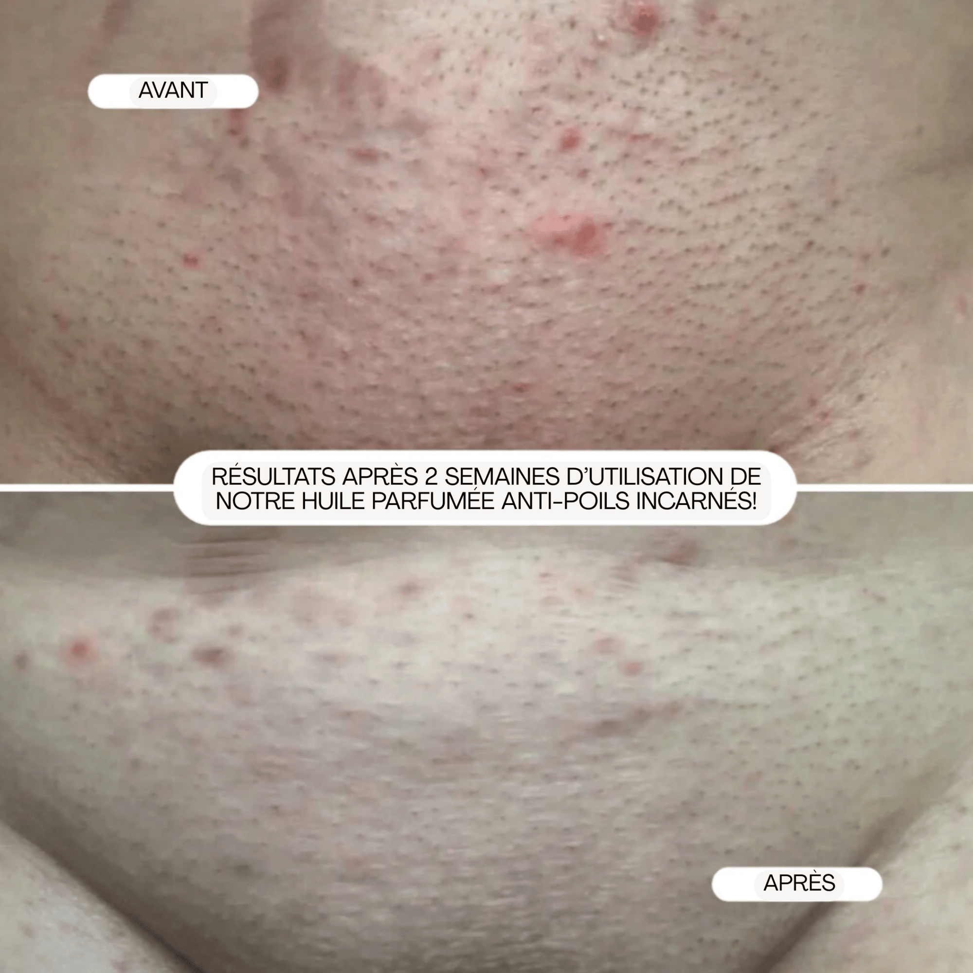 BushBalm | Sweet Escape | Huile Anti - Poils Incarnés - 53 Karat