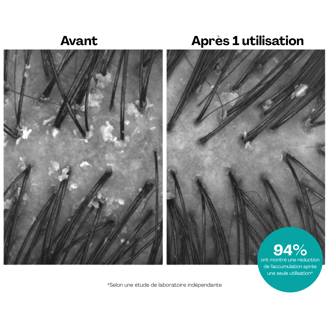 Moroccanoil | Scalp | Purifying Scrub - 53 Karat