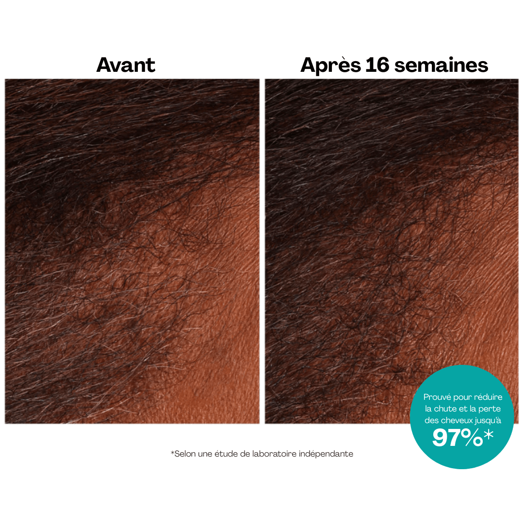 Moroccanoil | Scalp | Revitalizing Scalp Tonic - 53 Karat