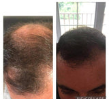 PROMO TRIO - Progressive hair loss - 3 month cure - René Furterer - 53 Karat